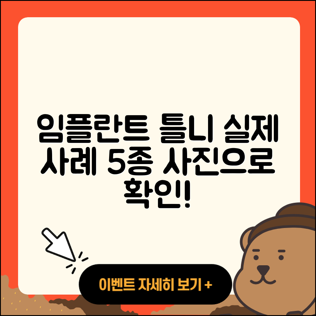 임플란트 틀니 사진 5가지 실제 사례